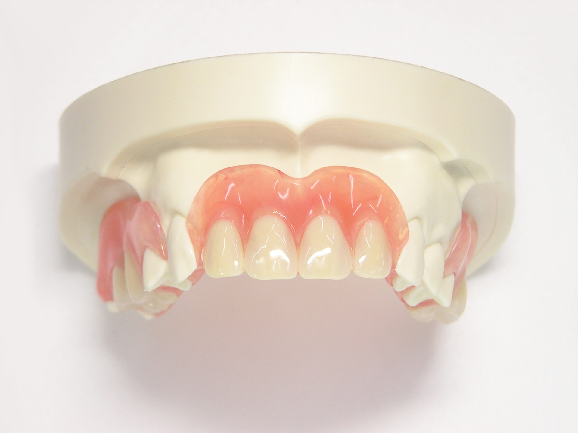 ミラクルフィットとはどんな義歯ですか？