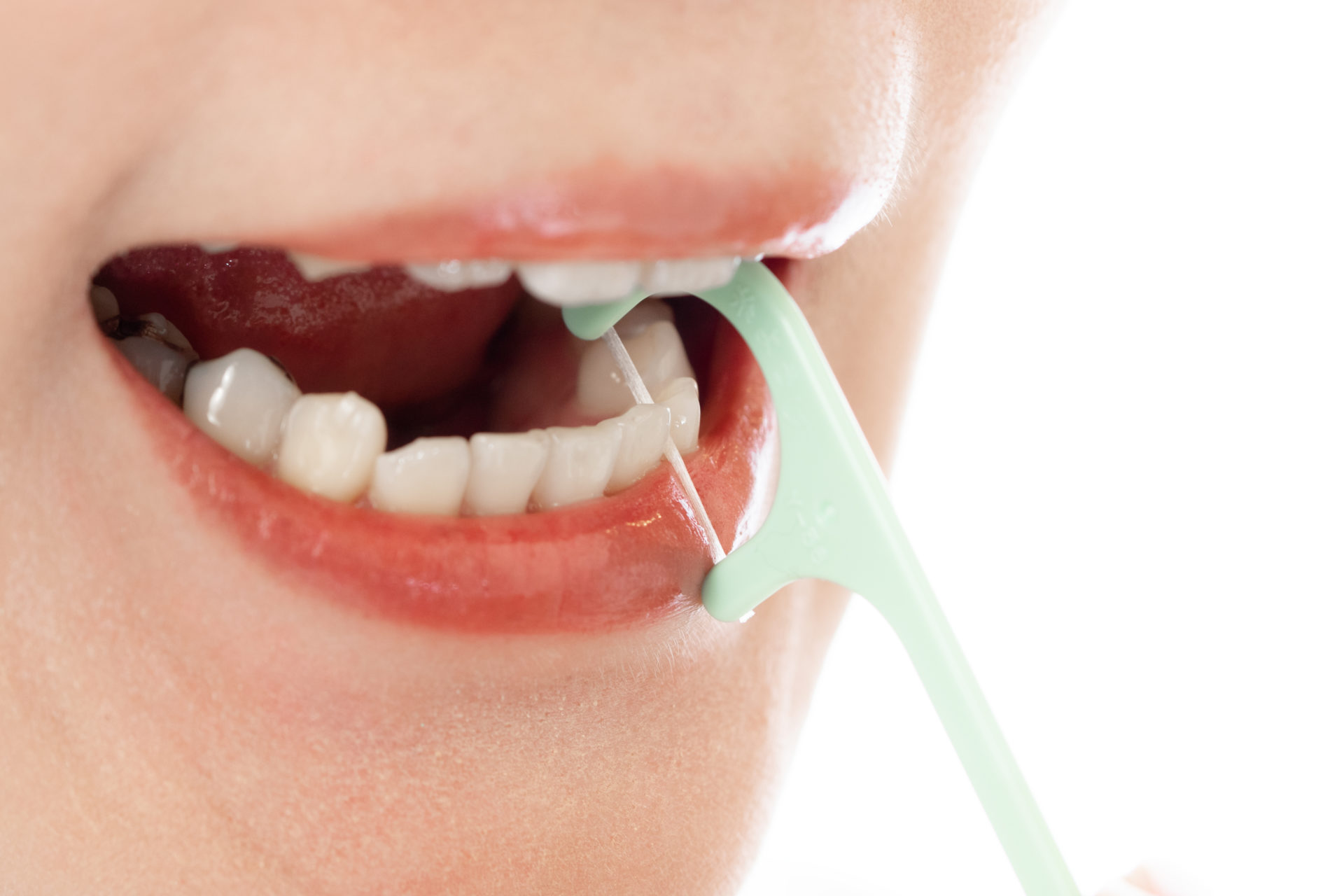デンタルフロスは歯ブラシで「歯を磨く前」が効果的